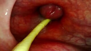 EXTREME ANAL POV CAMERA INSIDE HER ASSHOLE AS I POUND HER WITH MY BIG COCK AND CUM DEEP INSIDE