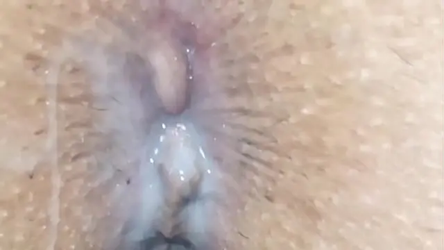 Slutty wife begging for anal and fucked hard in the ass hole and gets her hemorrhoids burst